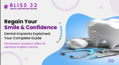 Understanding Dental Implants: What You Need to Know